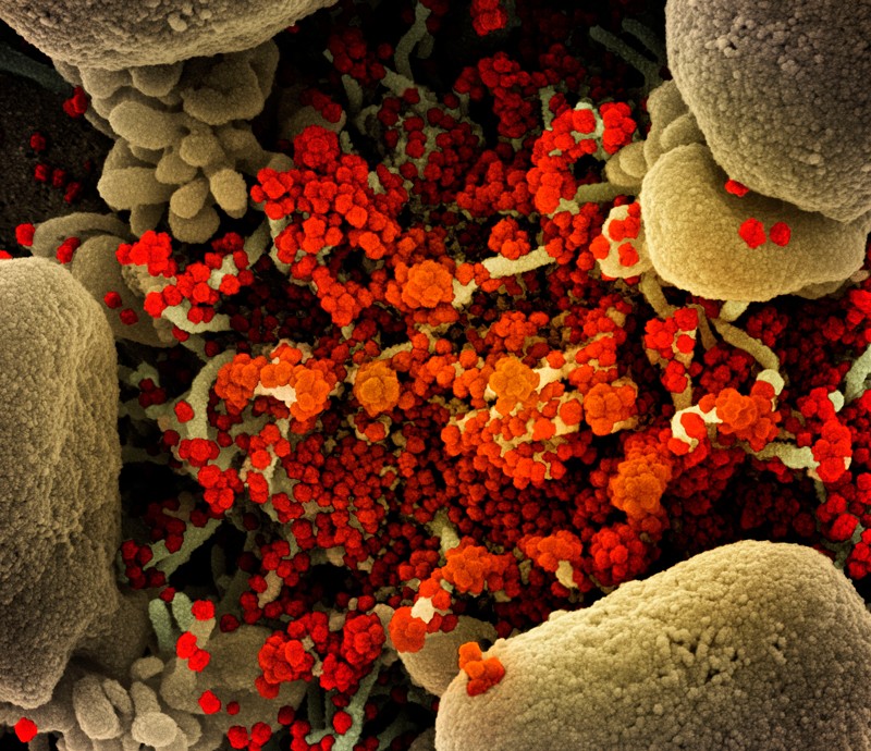 Particles (red) of SARS-CoV-2 infect a human cell.Credit: NIAID/National Institutes of Health/Science Photo Library