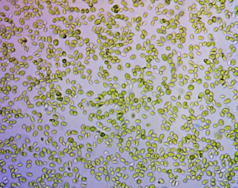 The microalgal species Scenedesmus obliquus (400x magnification) can grow at the CO2 levels found in the exhaust from various industrial processes. 