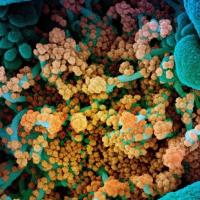Six months of coronavirus: the mysteries scientists are still racing to solve